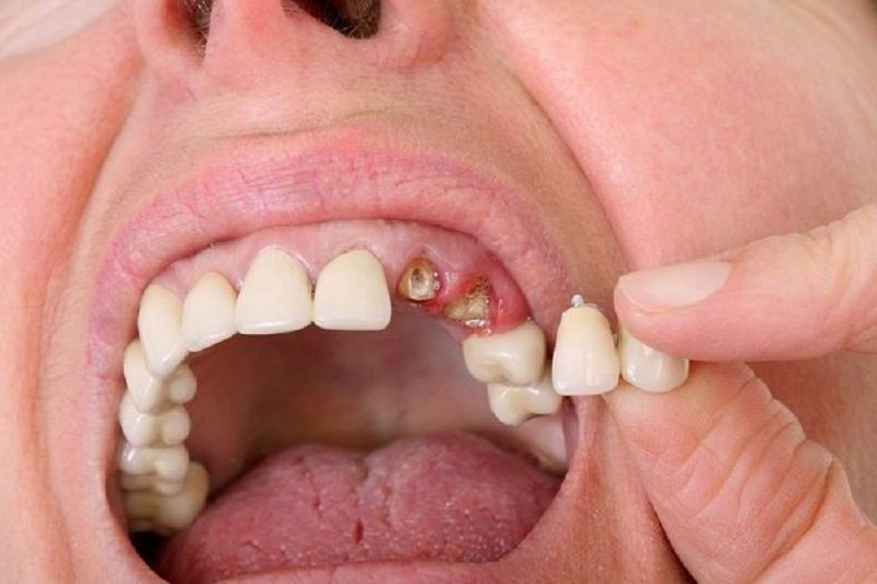 Giấc mơ rụng răng tại Top88: Thông điệp tâm linh và con số may mắn